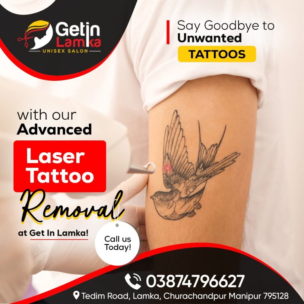 Say Goodbye to Unwanted Tattoos